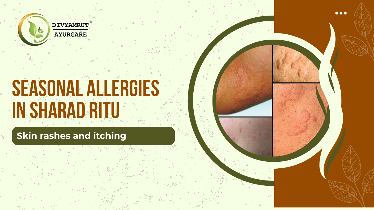  Seasonal Allergies in Sharad Ritu